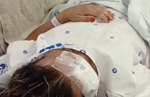Mulher trans agredida a pauladas e pedradas por três homens em Sepetiba segue internada e aguarda cirurgia no rosto: “Quero justiça”
