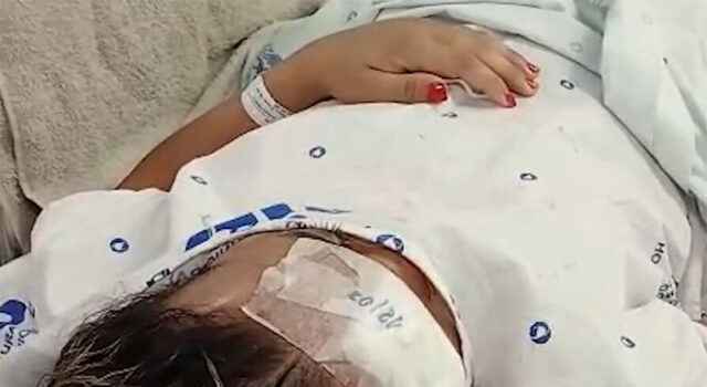 Mulher trans agredida a pauladas e pedradas por três homens em Sepetiba segue internada e aguarda cirurgia no rosto: “Quero justiça”