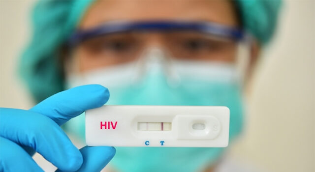 Pesquisa mostra que heterossexuais são maioria entre pacientes que descobrem HIV tardiamente