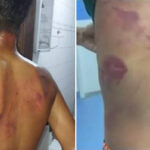 Adolescente de 13 anos é espancado pelo pai após homem vê-lo usando brincos em PE: “Era para eu ter matado”