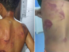 Adolescente de 13 anos é espancado pelo pai após homem vê-lo usando brincos em PE: “Era para eu ter matado”