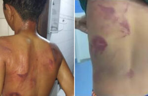 Adolescente de 13 anos é espancado pelo pai após homem vê-lo usando brincos em PE: “Era para eu ter matado”