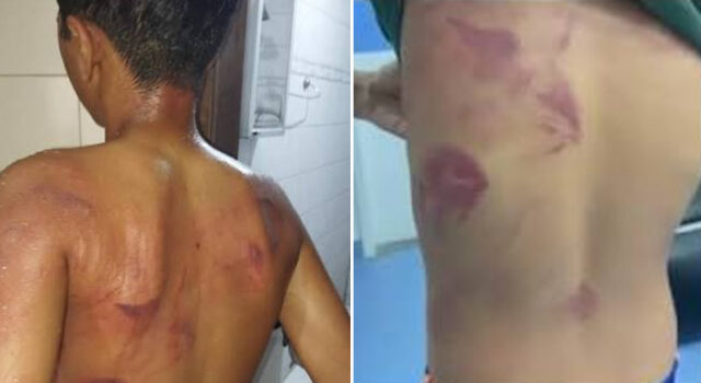 Adolescente de 13 anos é espancado pelo pai após homem vê-lo usando brincos em PE: “Era para eu ter matado”