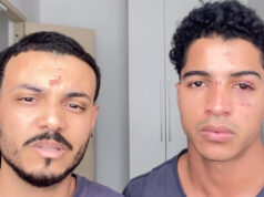 Aluno denuncia agressão e homofobia sofridas com o namorado após festa em prédio da UFRJ: “Quer apanhar, viadinho?”