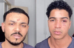 Aluno denuncia agressão e homofobia sofridas com o namorado após festa em prédio da UFRJ: “Quer apanhar, viadinho?”
