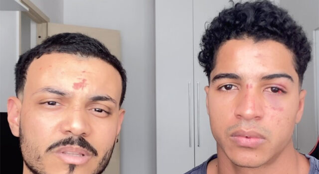 Aluno denuncia agressão e homofobia sofridas com o namorado após festa em prédio da UFRJ: “Quer apanhar, viadinho?”