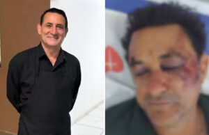 Garçom de 60 anos é espancado por jovens em caso investigado como tentativa de homicídio e homofobia em SP