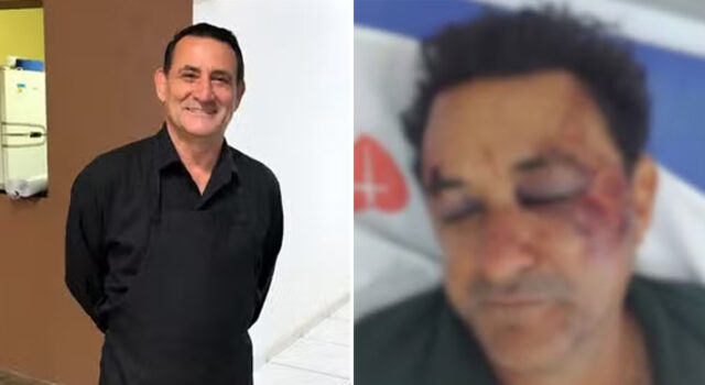 Garçom de 60 anos é espancado por jovens em caso investigado como tentativa de homicídio e homofobia em SP