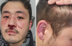 Câmera registra momento em que professor é espancado no metrô de SP; caso é investigado como homofobia