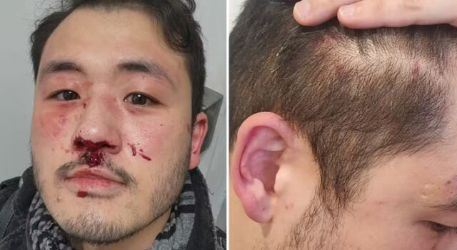 Câmera registra momento em que professor é espancado no metrô de SP; caso é investigado como homofobia